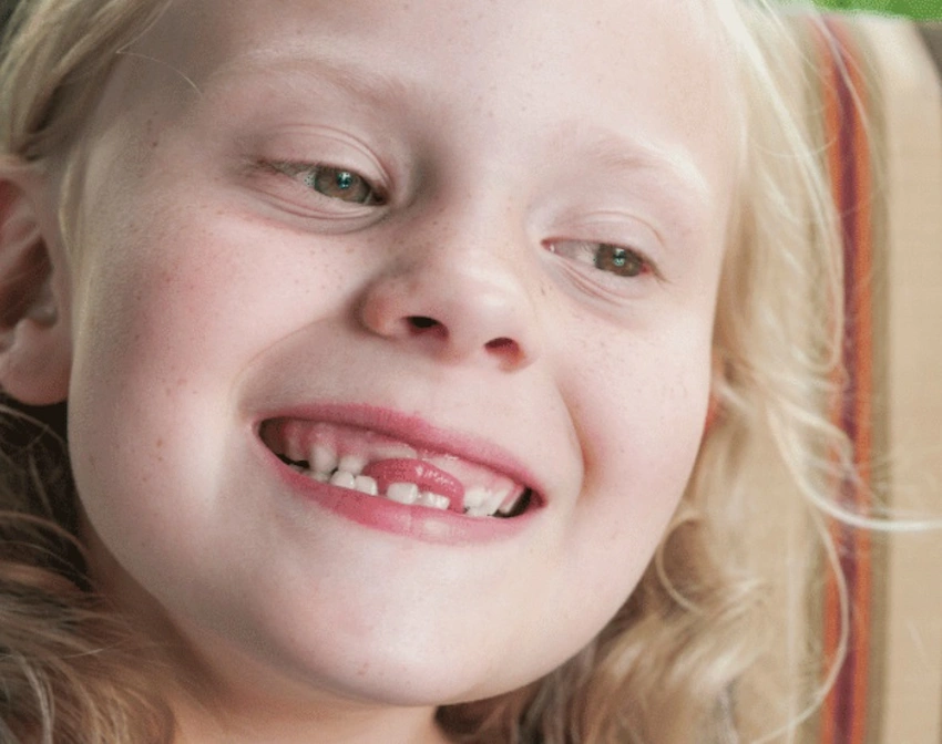 appuí la langue sur les dents enfant