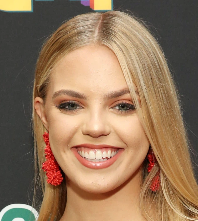 renee rapp teeth in 2018