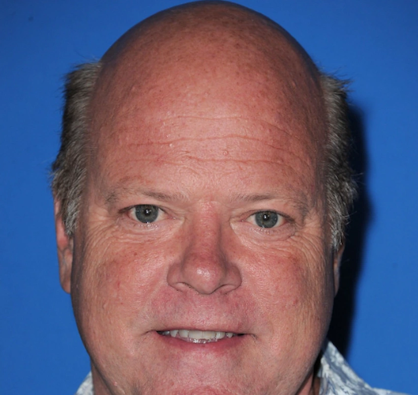 rex linn denti 2010