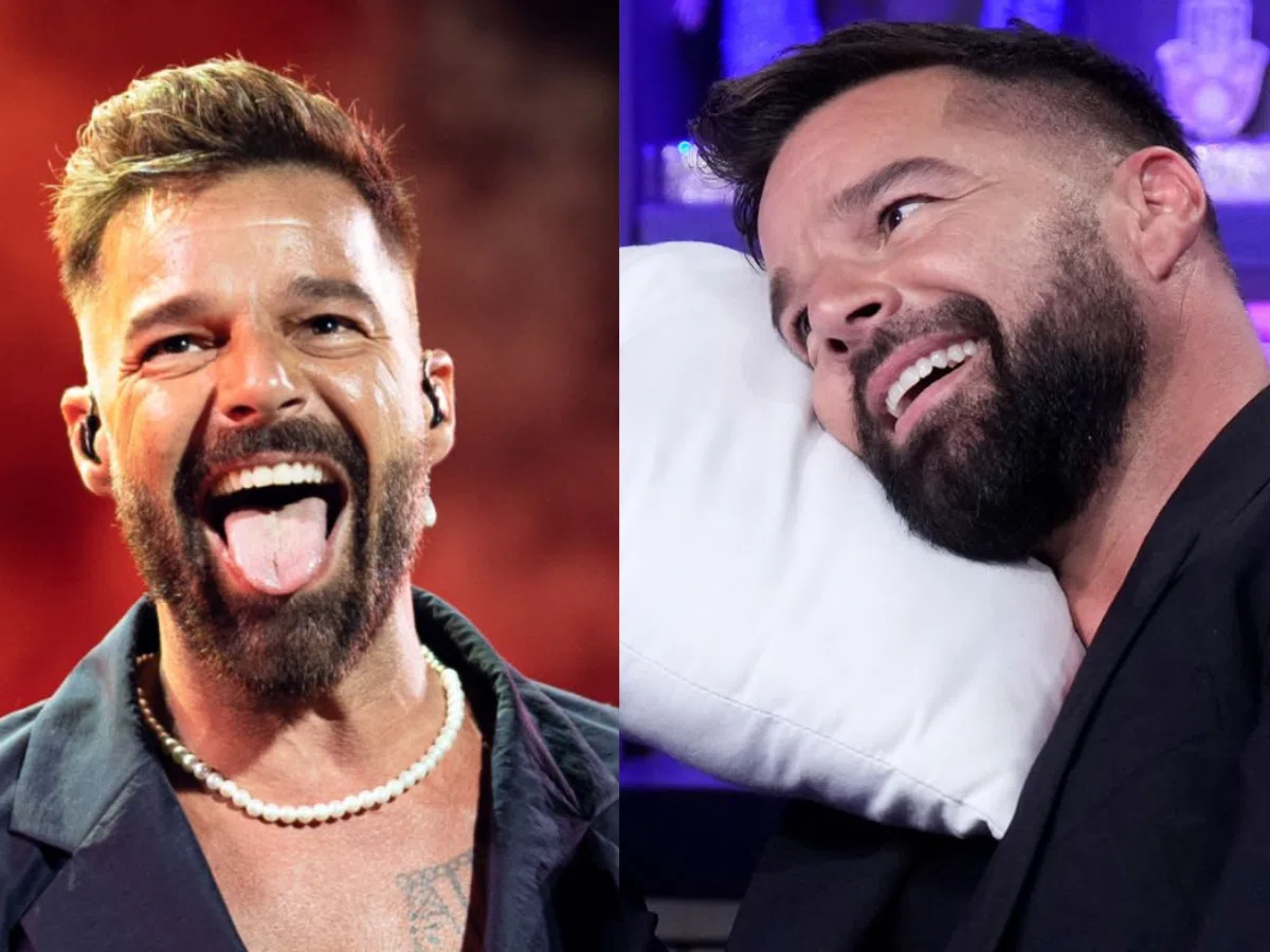 ricky martin teeth before after