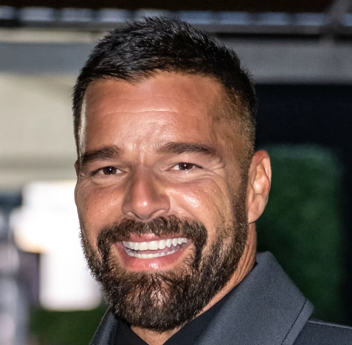 ricky martin zähne im jahr 2025