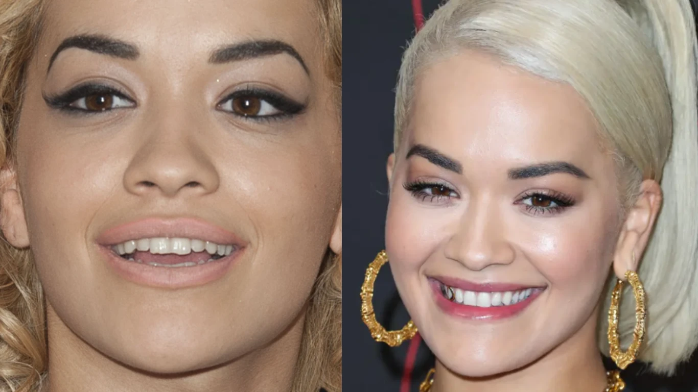 rita ora before after