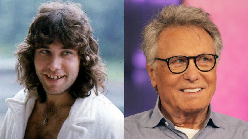 robert lamm teeth before after