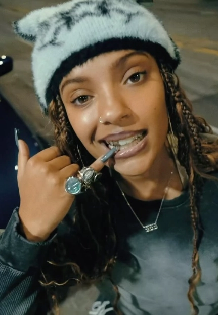 samara cyn mostrando sus grillz dentales