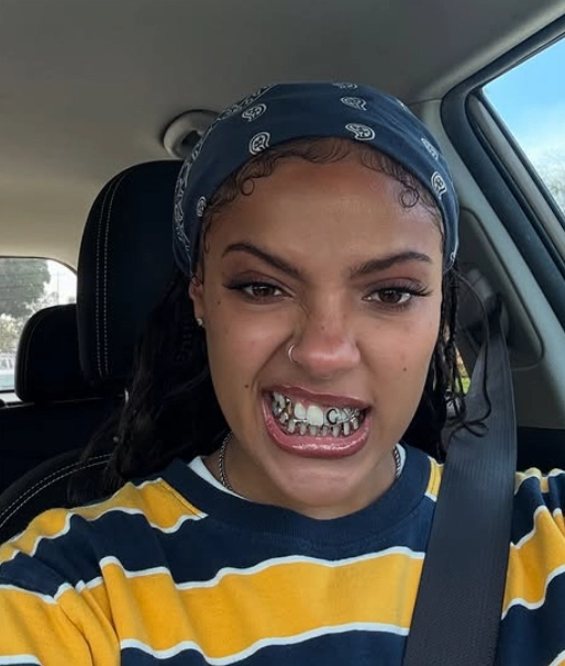 grillz dentales de samara cyn