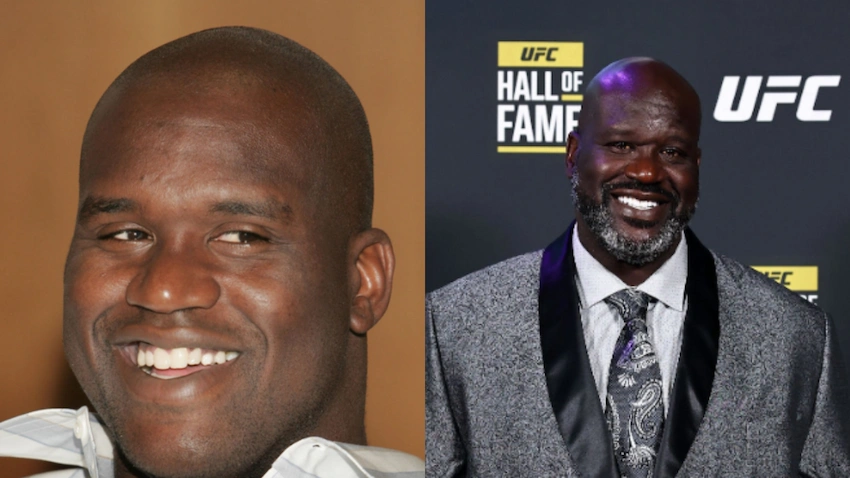 shaquille oneal teeth before after