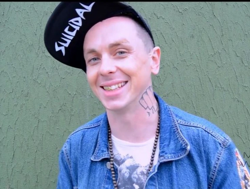 sid wilson teeth 2010