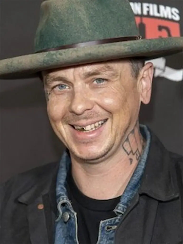 sid wilson teeth 2015