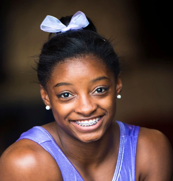 simone biles teeth 2013