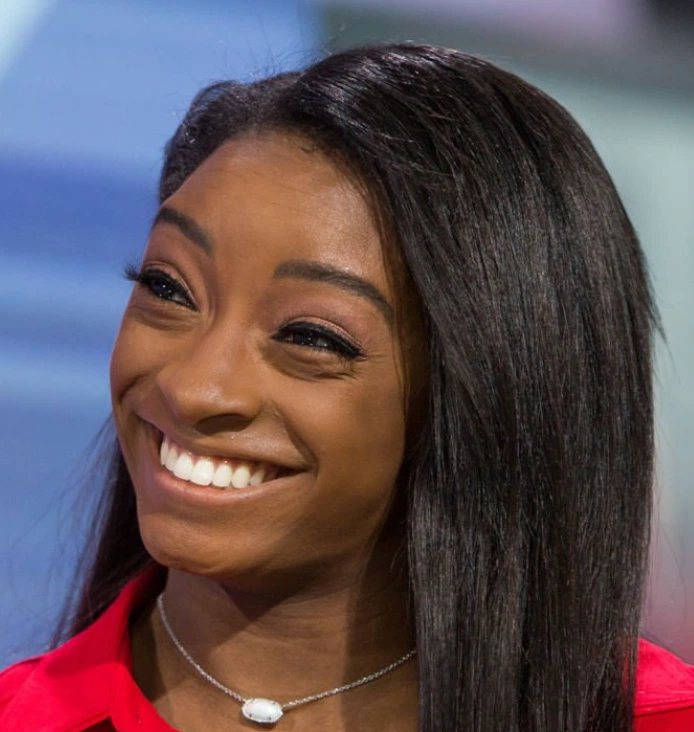 simone biles teeth 2017