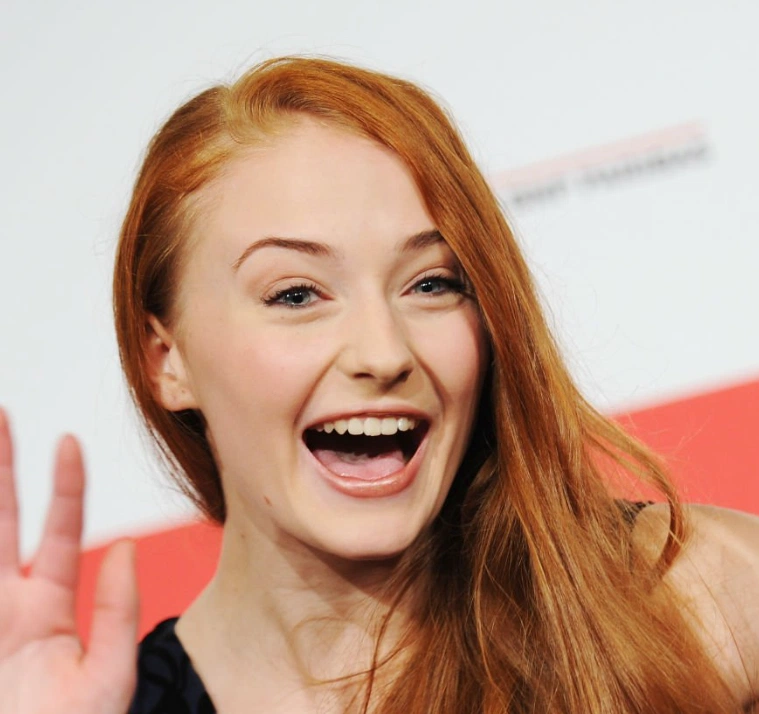 sophie turner 2013'teki dişleri