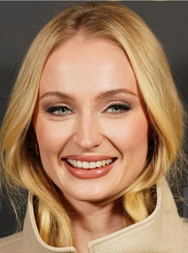Sophie Turner's New Teeth Now - Before and After - Lema Dental Clinic