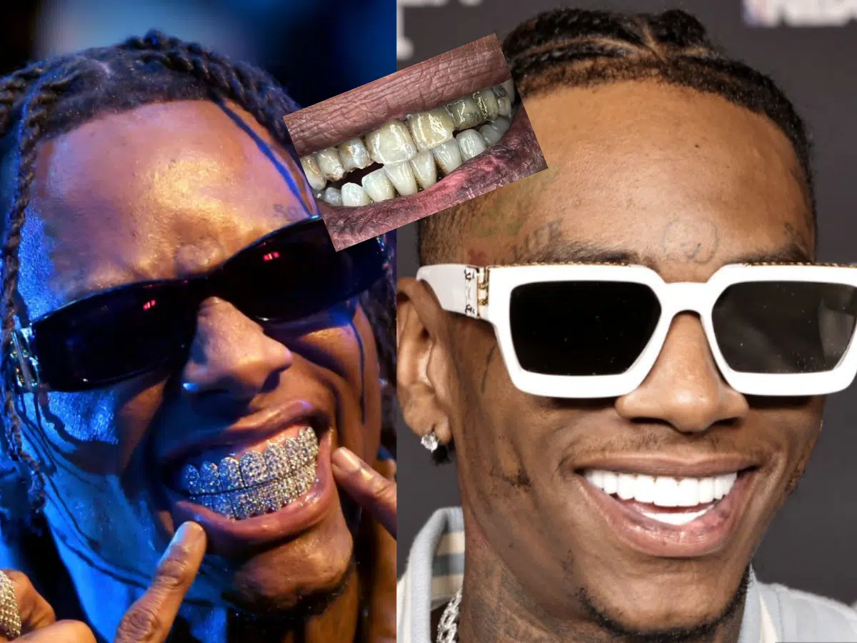 soulja boy teeth before after