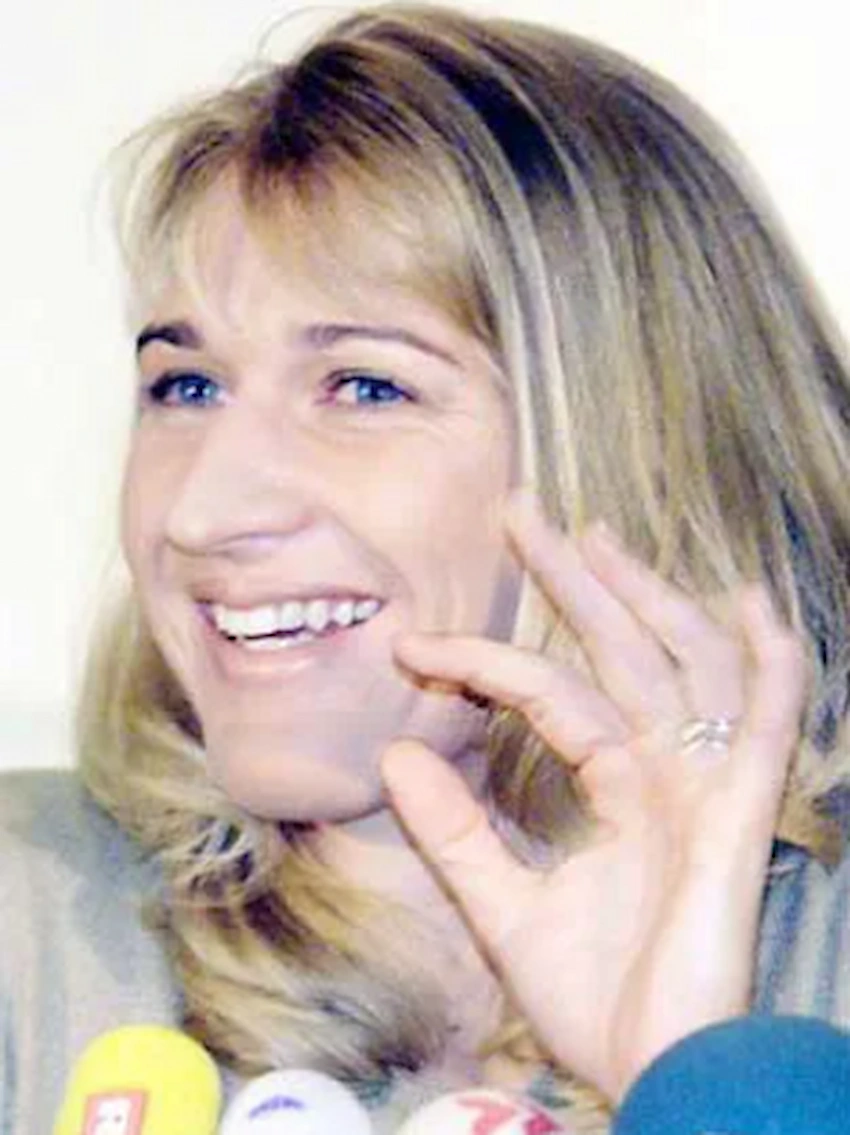 dientes de steffi graf 1990