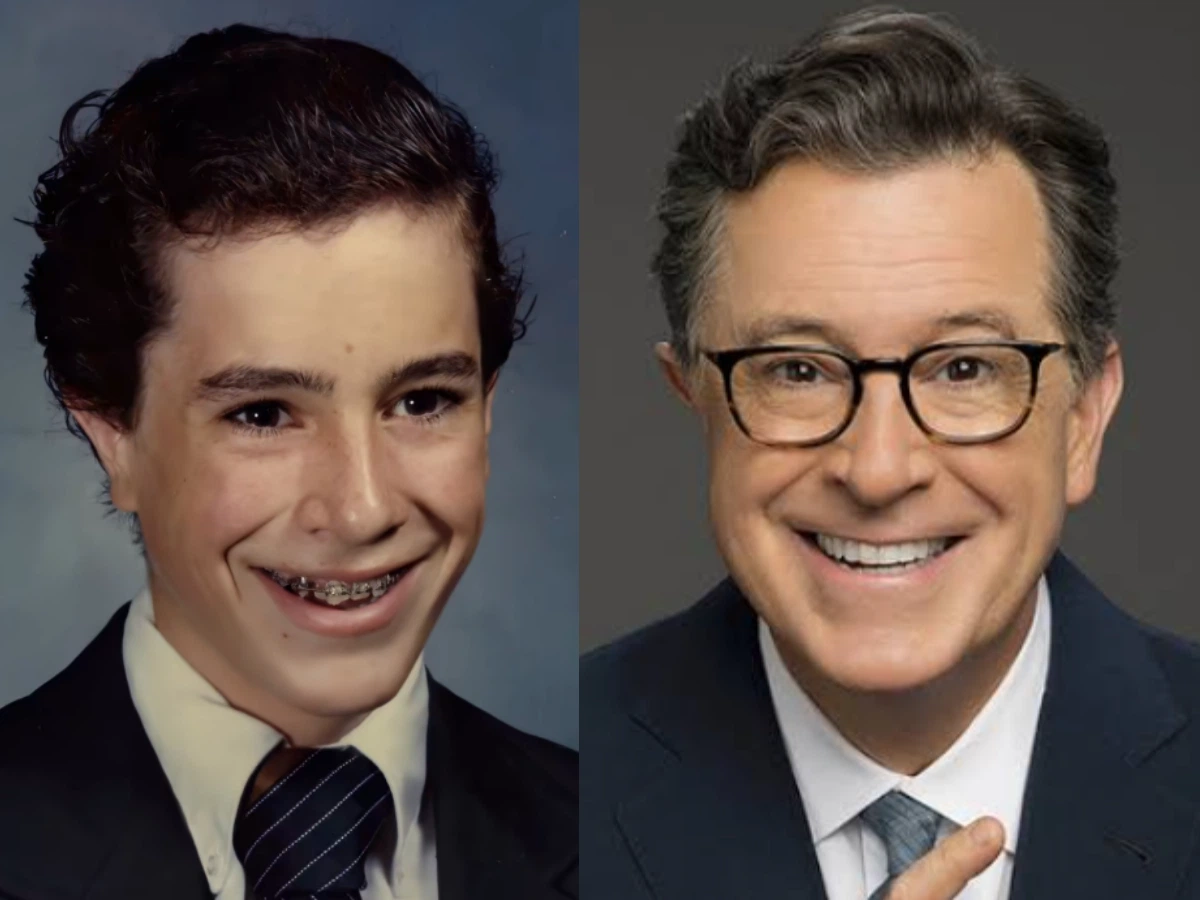 stephen colbert teeth before after