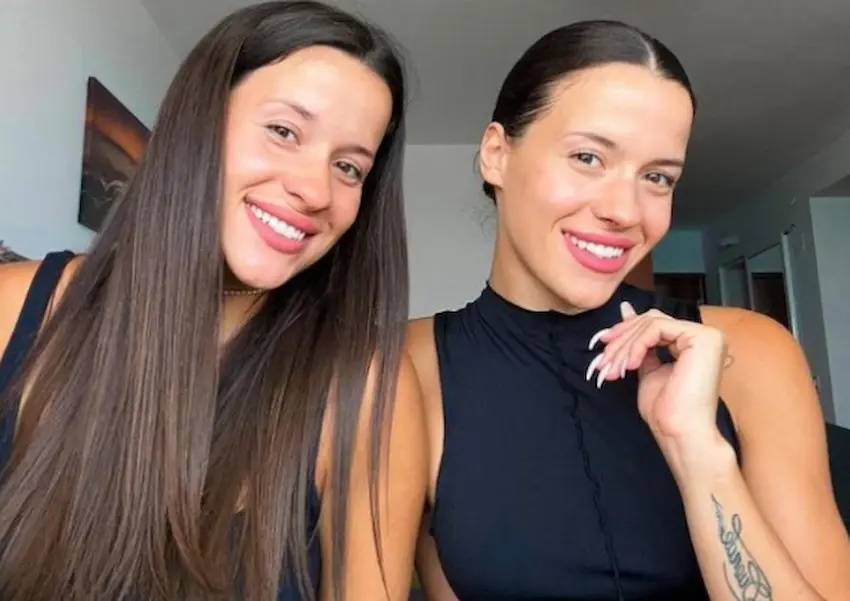 suzi reni teeth 2025s