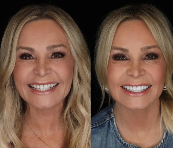tamra judge transformation
