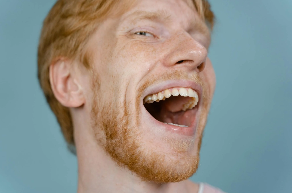 couverture des dents de devant