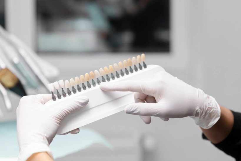 examen de blanchiment des dents