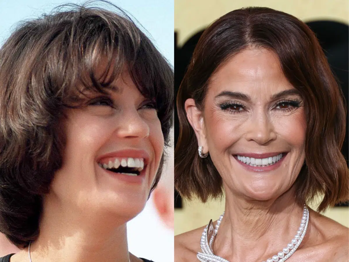 teri hatcher teeth before after