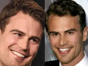 theo james teeth before after