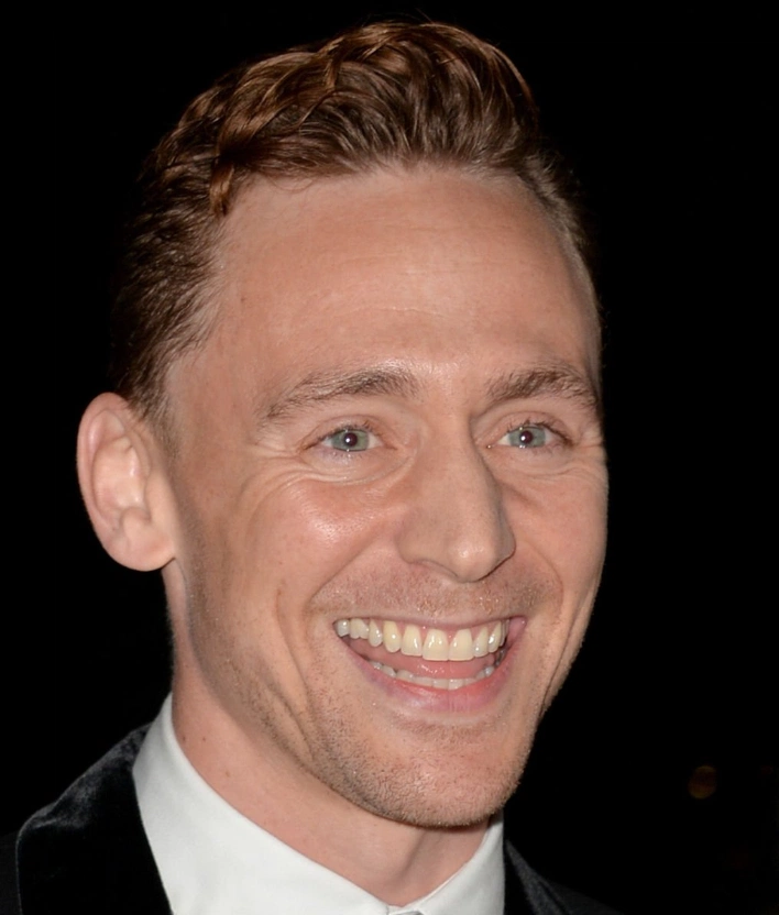 tom hiddleston teeth in 2013