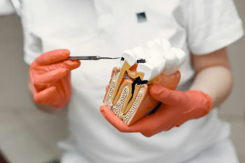 tooth decay