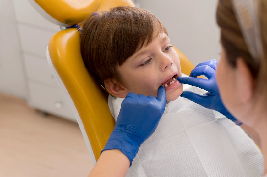 tooth fractures in kids why and what happens