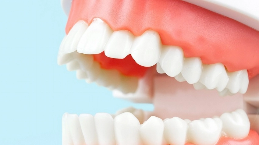 upper jaw