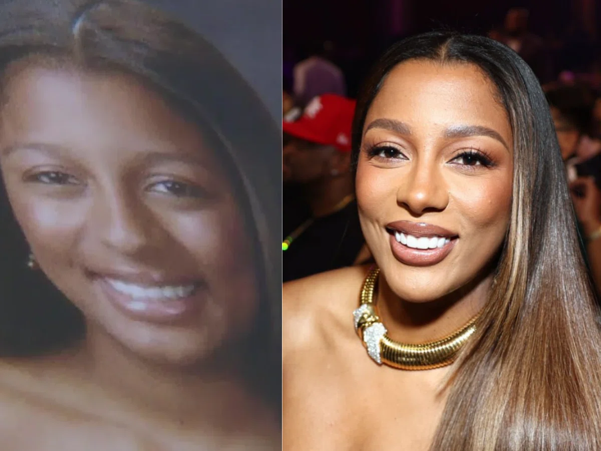 victoria monét teeth before after