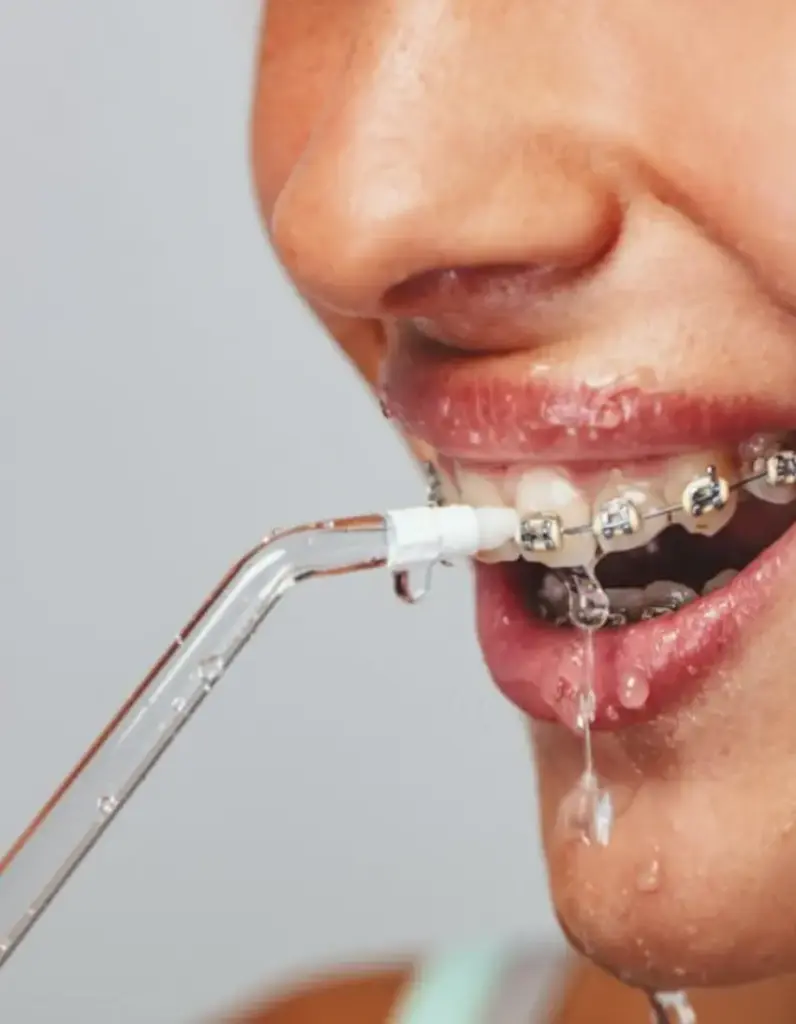 water flosser teeth p