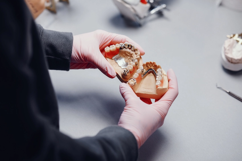 what are temporary dentures and what are their types