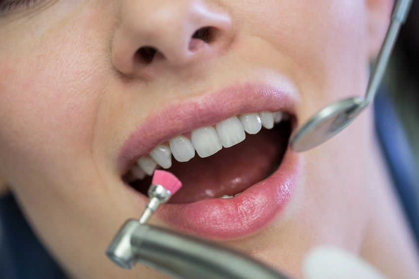 what are the causes of tooth enamel cracks