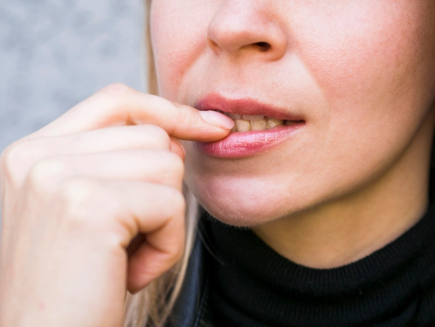 what causes black spots on teeth