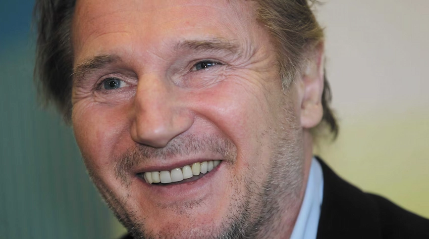 what happened to liam neeson teeth