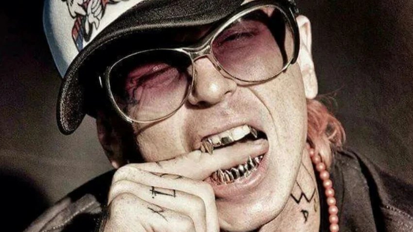 what happened to sid wilson teeth