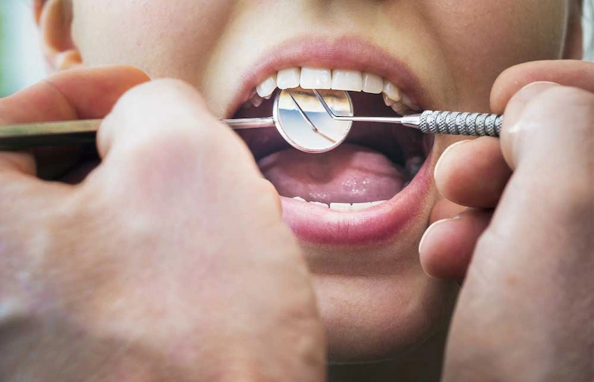 qu'est-ce que la décomposition des dents de devant