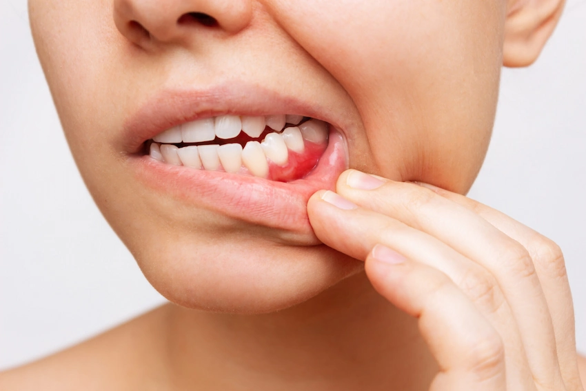 what should be done to strengthen gums