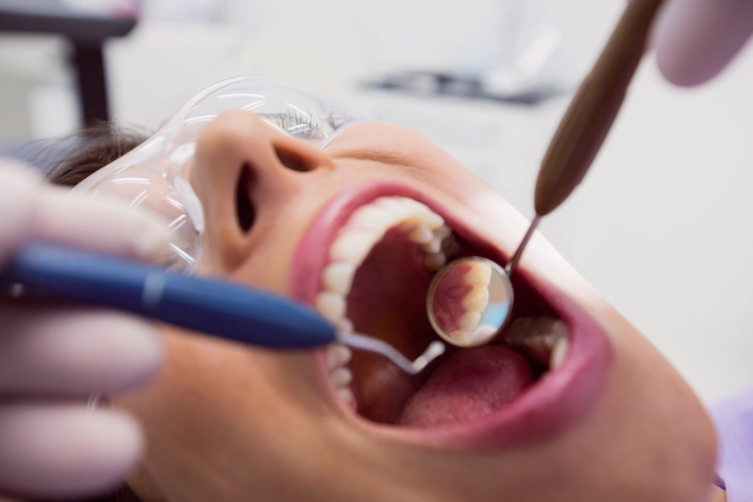what situations should i see a doctor after a dental filling