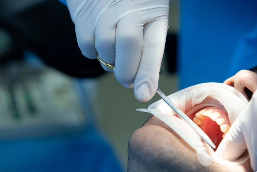 when is a tooth extraction ncessary