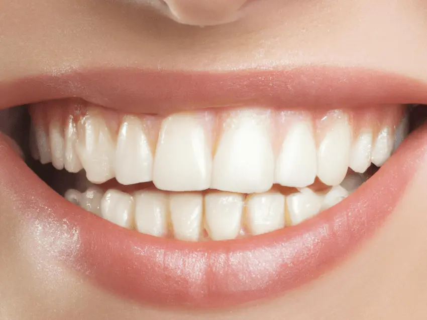 bolígrafo para dientes blancos