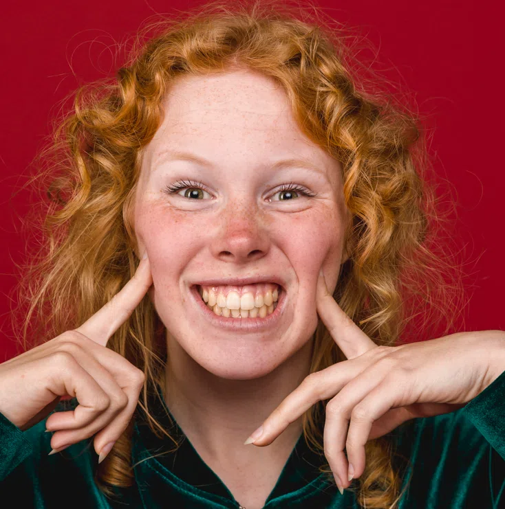dientes amarillos