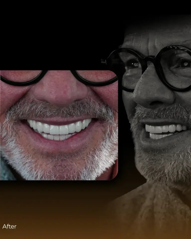 ✨ Your journey to a perfect smile begins at Lema Dental Clinic! We combine art and technology t (4) (1)