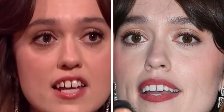 aimee lou wood teeth