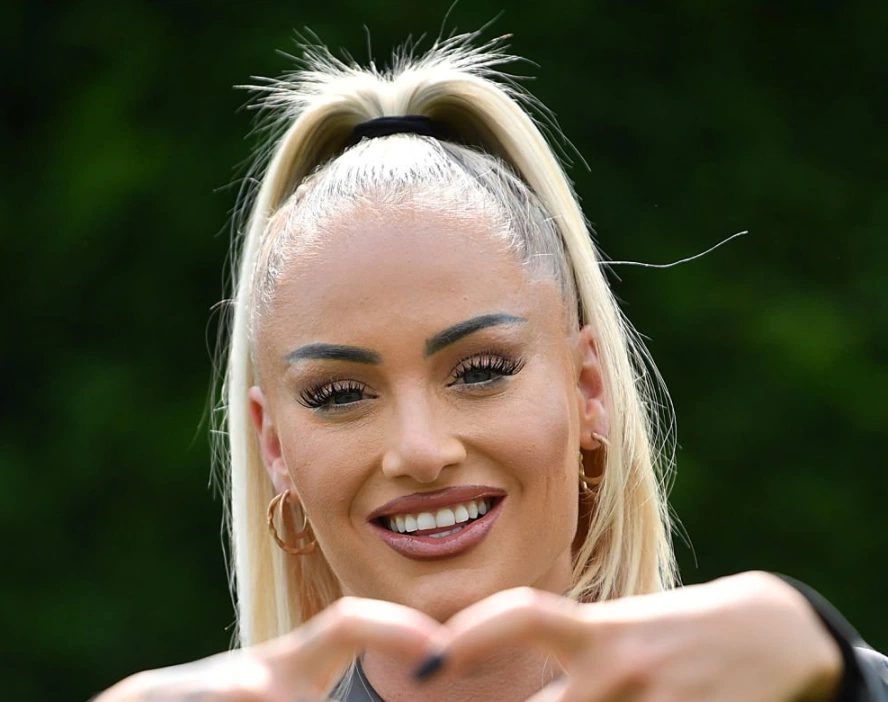 alisha lehmann zähne 2024