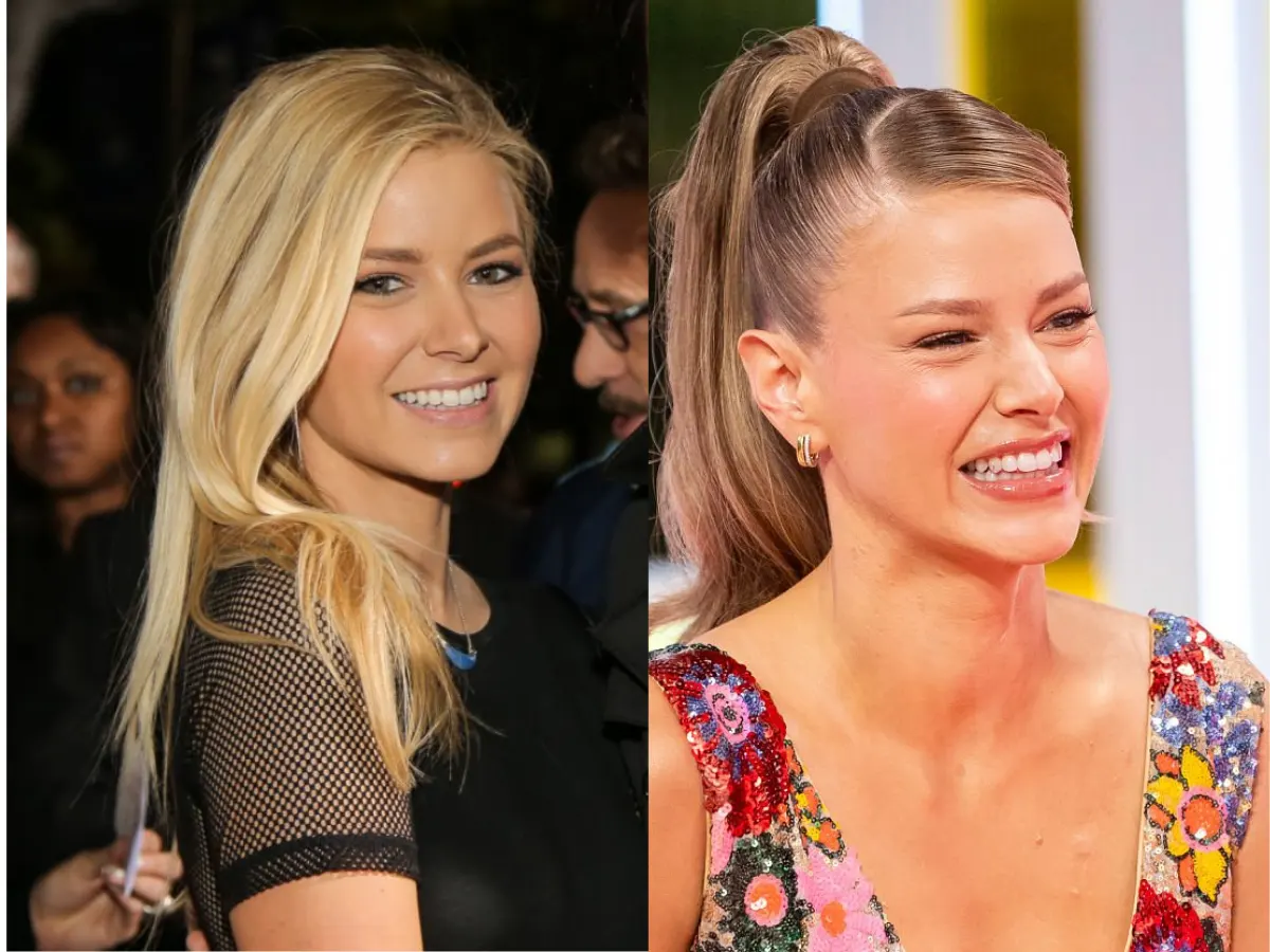 ariana madix teeth before and after