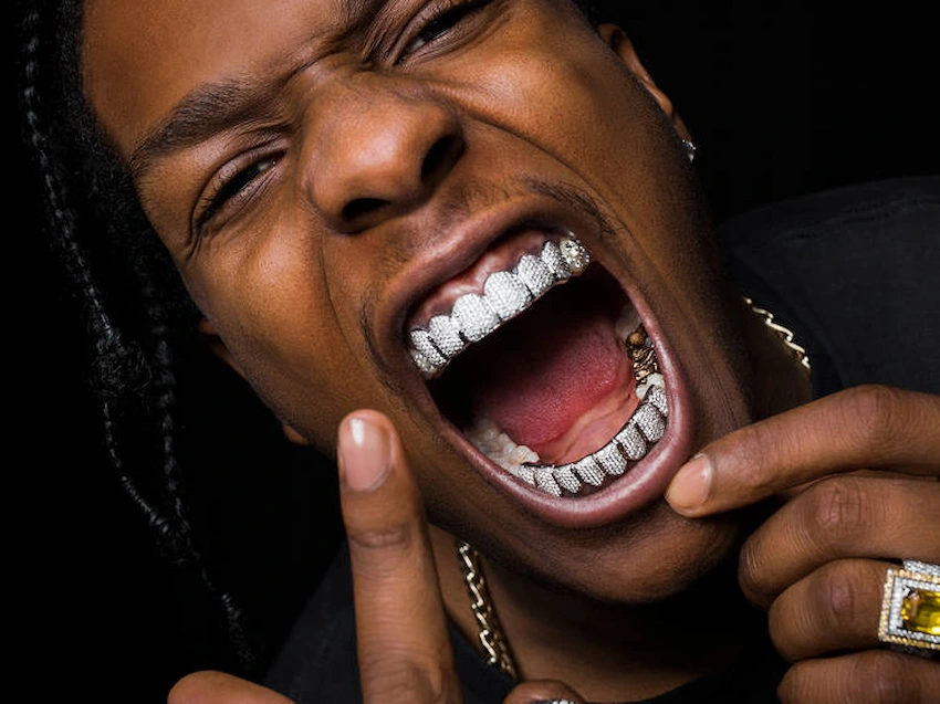 asap rocky sparkling dental veneers