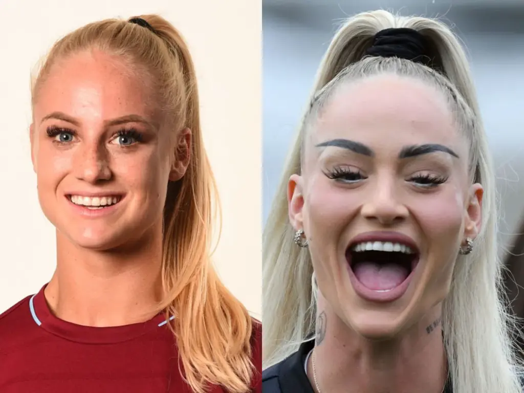 alisha lehmann zähne vor und nach