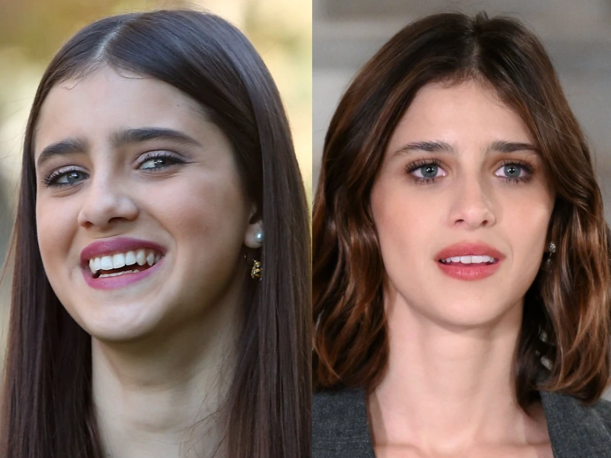 benedetta porcaroli teeth before after
