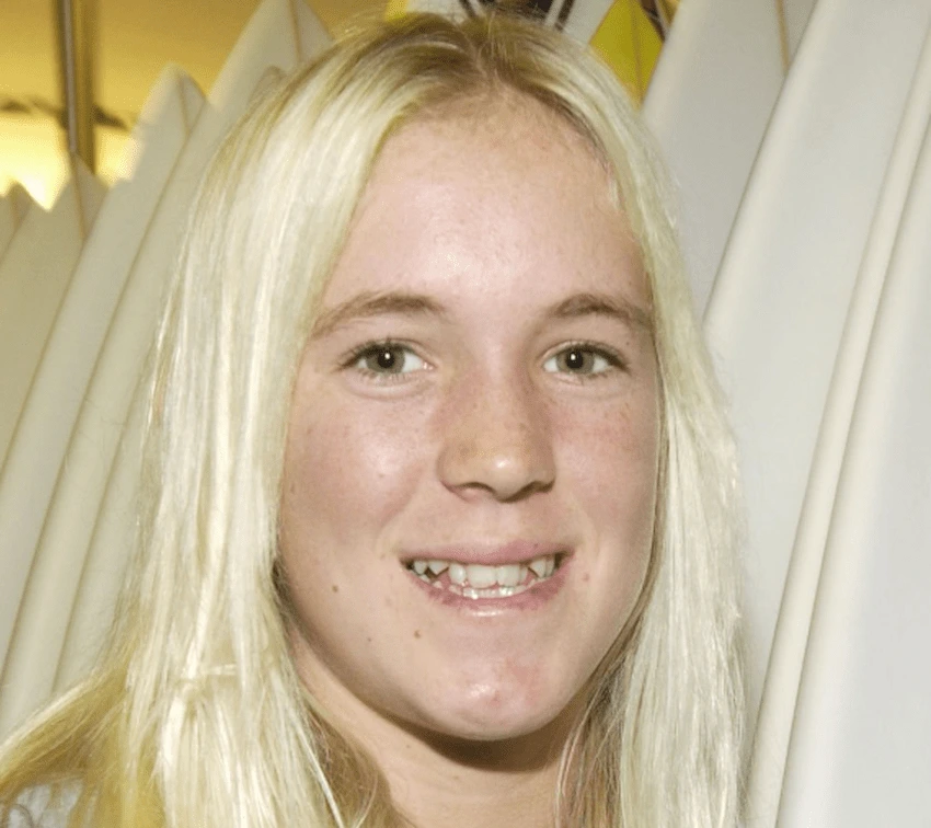 bethany hamilton teeth 2003